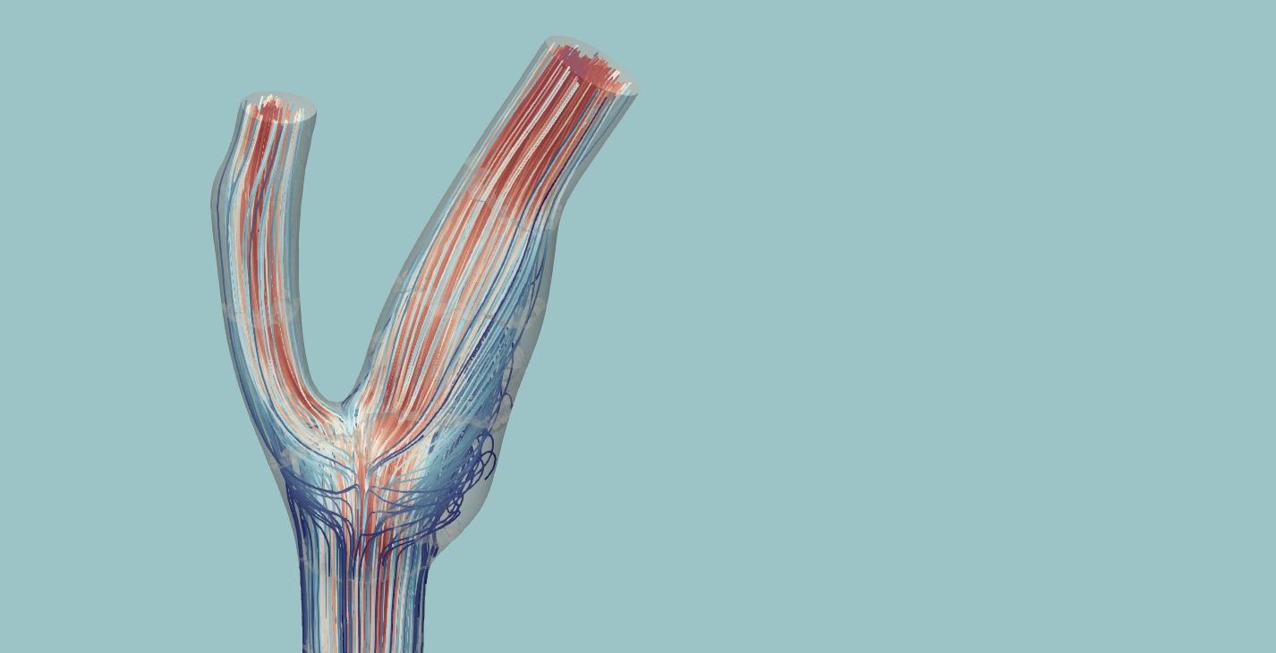 Streamlines through a transparent three-dimensional carotid artery geometry